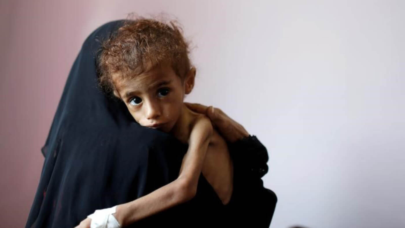 Life in Yemen: famine, disease and human rights violations